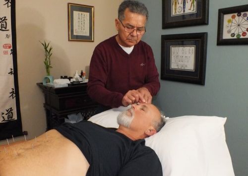 Juan giving a patient acupuncture procedure in his clinic room.